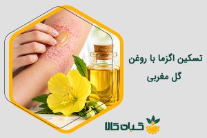 روغن گل مغربی برای اگزما